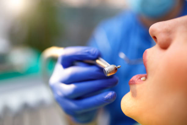 Full Mouth Reconstruction in Delhi, LA